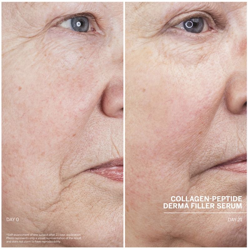 SMALL SIZE Doctor Babor Collagen-Peptide Derma Filler Serum 
